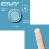 PATCHS SOS BOUTONS Hydrocolloïde - Visage & Corps X18